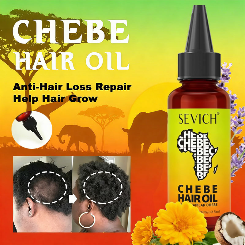 Hair Care Essence Oil Spray - زيت تشيبي لنمو الشعر السريع، زيت