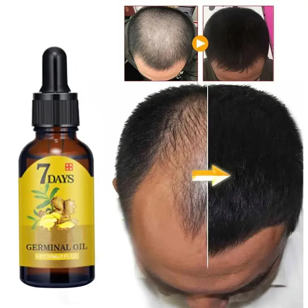 Hair Care Essence Oil Spray - نمو الشعر الزنجبيل سريع النمو زيت