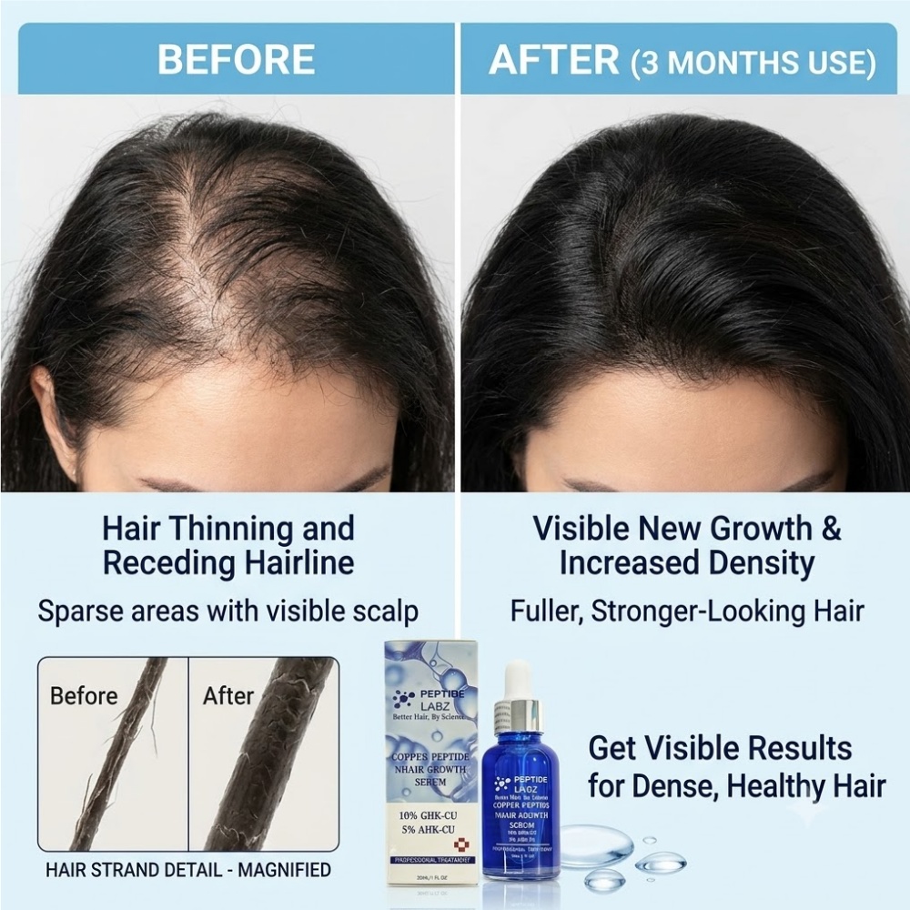 سيروم نمو الشعر بببتيد النحاس  - مراجعة Hair Care Elseve وسعره