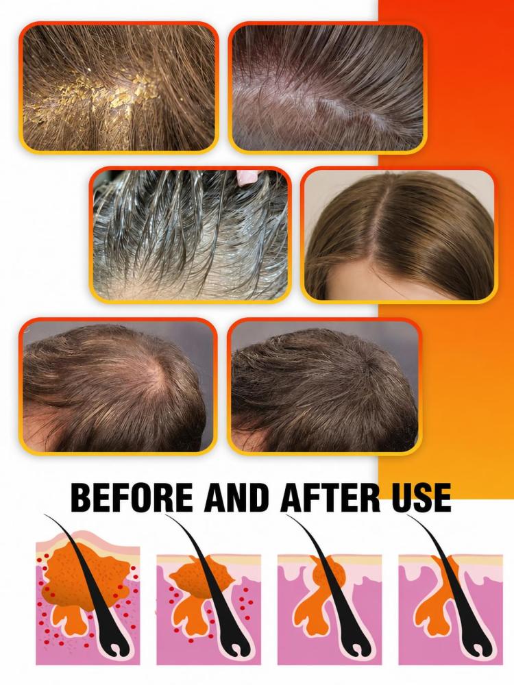 شامبو الكبريت لتنظيف الشعر للا - مراجعة Hair Care Daily Routine وسعره