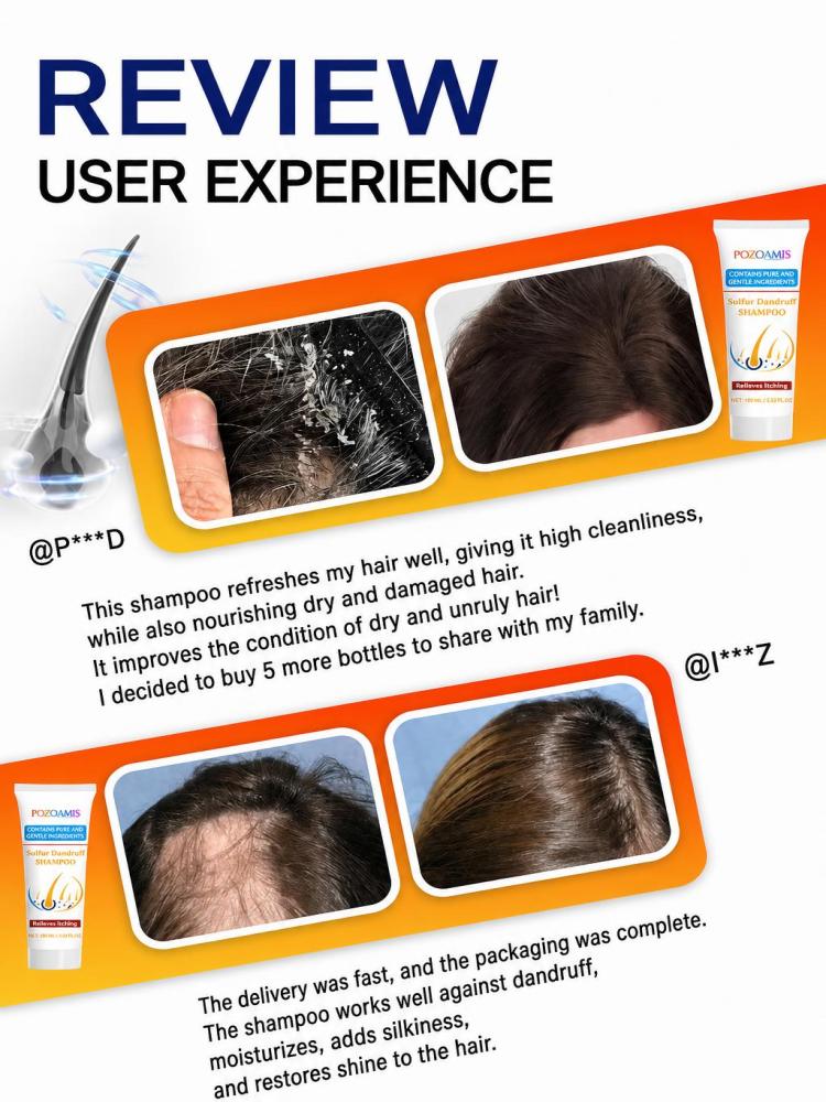 شامبو الكبريت لتنظيف الشعر للا - مراجعة Hair Care Daily Routine وسعره