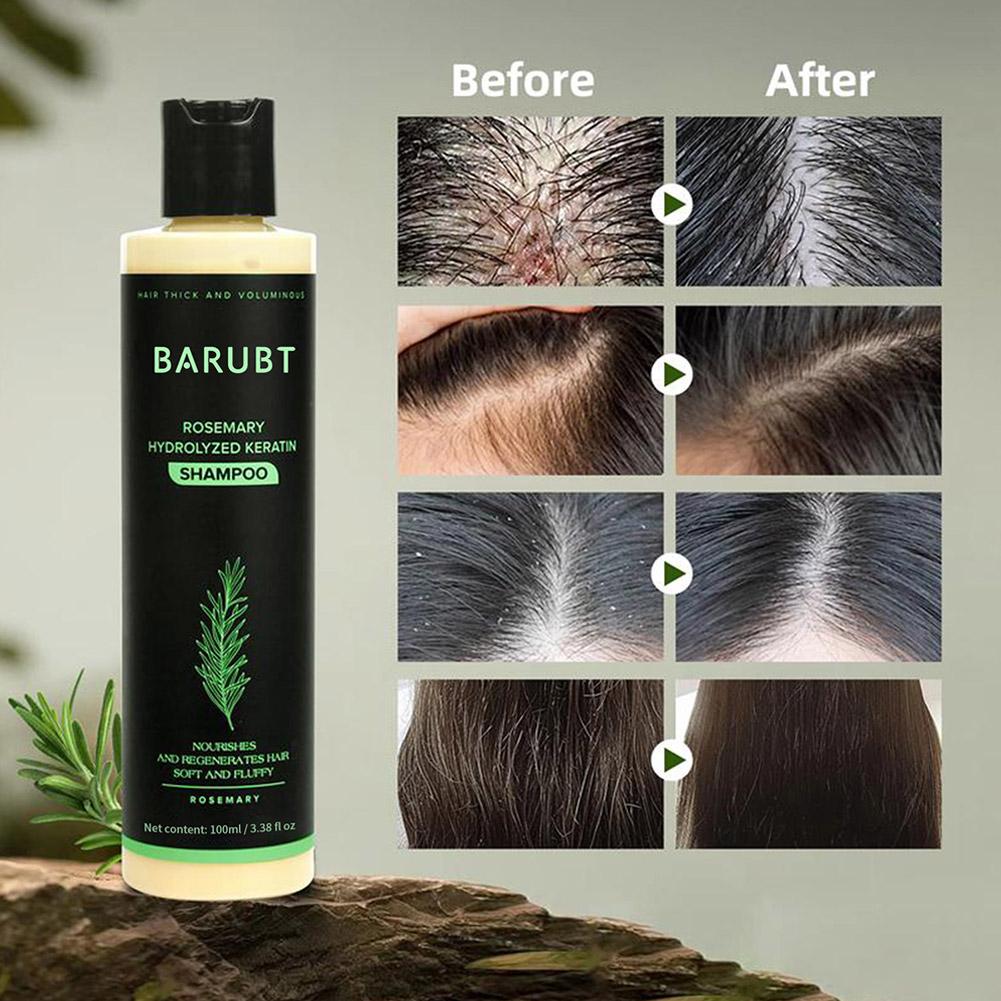 شامبو روزماري لنمو الشعر، تنظي - مراجعة Rosemary Hair Oil وسعره