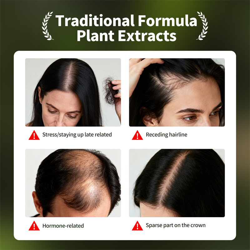 مجموعة نمو الشعر الطبيعي صابون - مراجعة Hair Care Essence Oil Spray وسعره