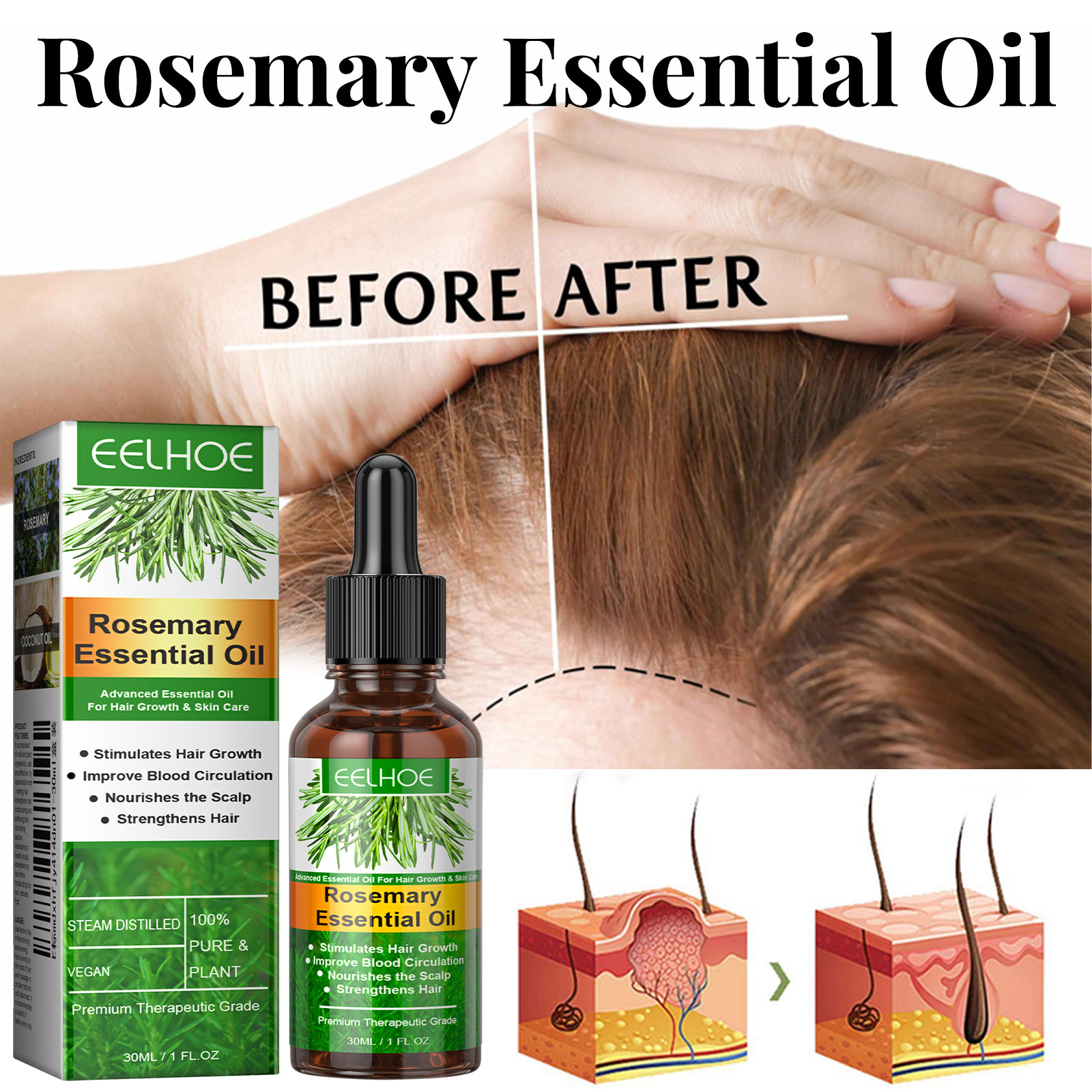 مصل نمو الشعر مجموعة العناية ب - مراجعة Hair Care Essence Oil Spray وسعره