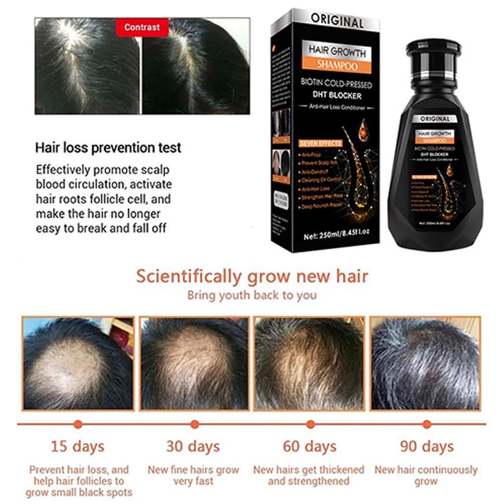 شامبو البيوتين والزنجبيل تركيب - مراجعة Biotin Shampoo Thickening وسعره