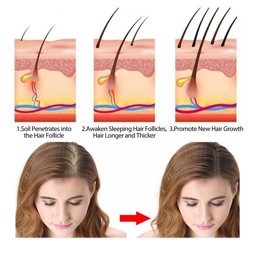 صابون شامبو روزماري زنجبيل/خيز - مراجعة Hair Care Elseve وسعره