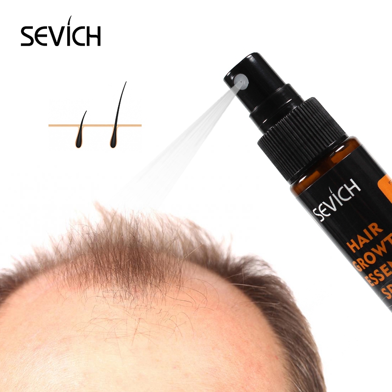 Sevich 30 مللي زيت Hebal جوهر  - مراجعة Hair Care Essence Oil Spray وسعره
