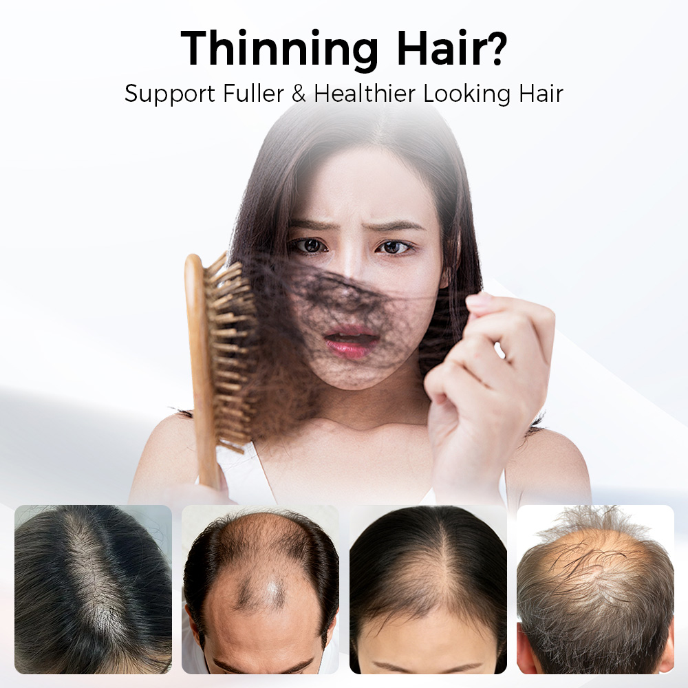 قبعة LED لنمو الشعر بالعلاج ال - مراجعة Hair Care Elseve وسعره