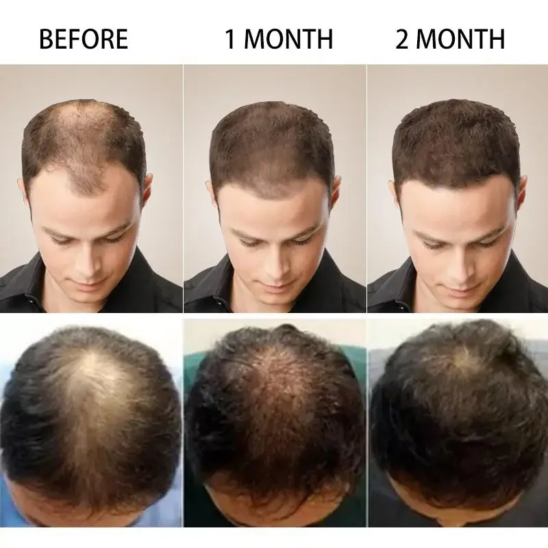 نمو الشعر الزنجبيل سريع النمو  - مراجعة Hair Care Essence Oil Spray وسعره